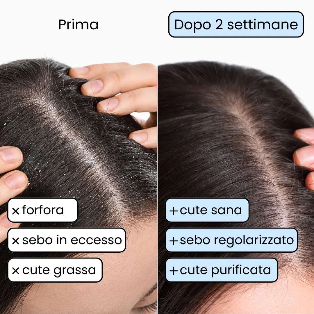 Shampoo Solido Purificante per capelli Grassi