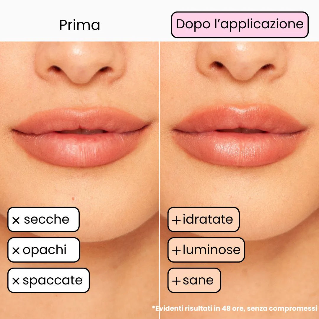 Balsamo Labbra BERRY - Mora e Mirtillo