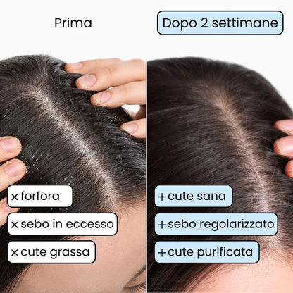 Shampoo Solido Purificante per capelli Grassi